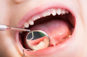 orthodontics for children